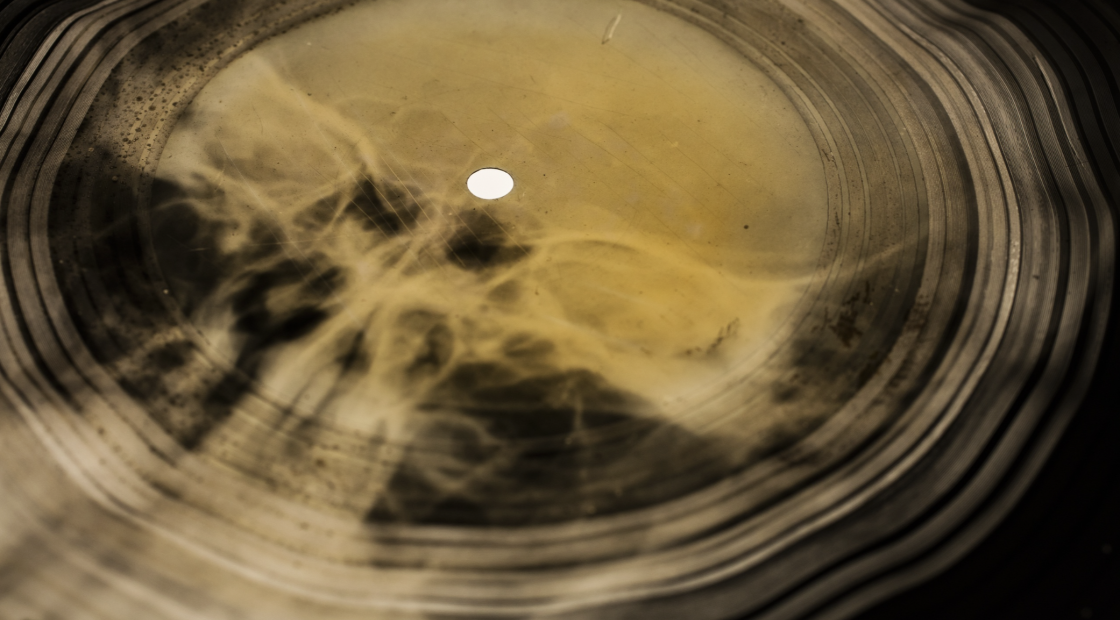 Фрагмент пластинки из коллекции X-Ray Audio на выставке в музее «Гараж»