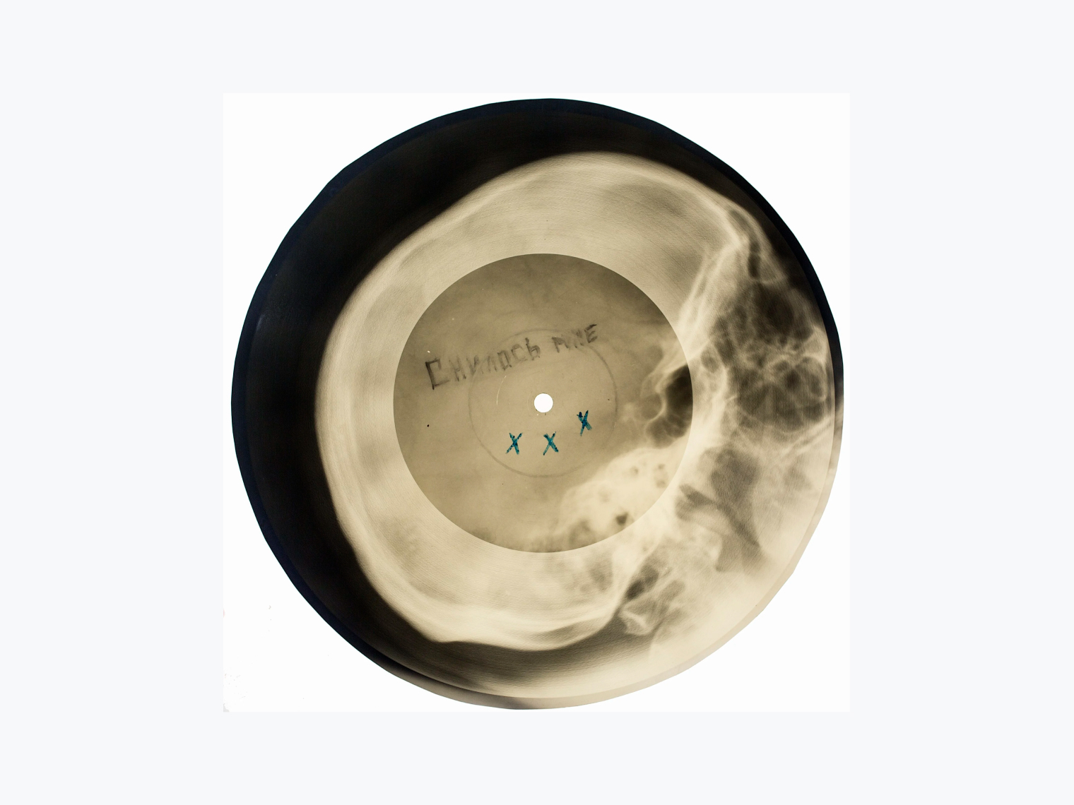 Так выглядели пластинки на рентгеновских снимках © Коллекция X-Ray Audio / x-rayaudio.squarespace.com