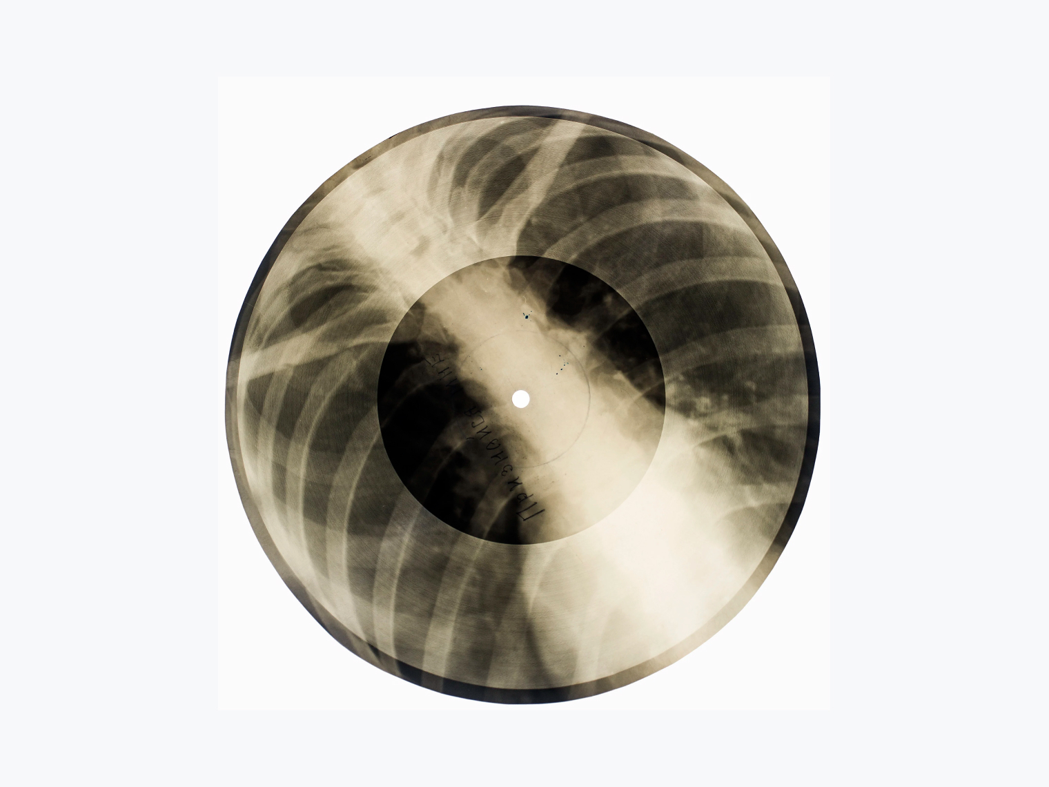 Так выглядели пластинки на рентгеновских снимках © Коллекция X-Ray Audio / x-rayaudio.squarespace.com